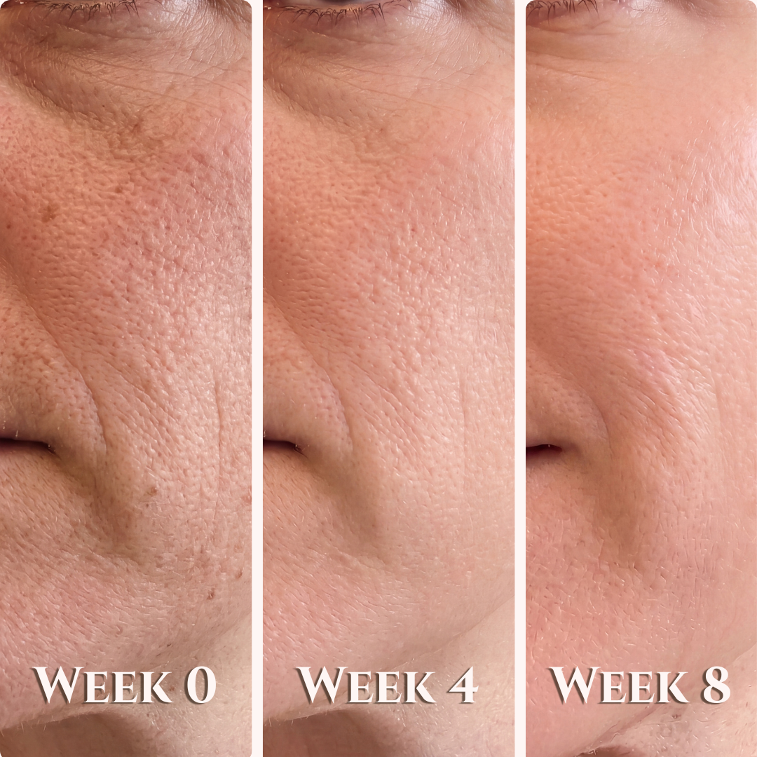 BlossiqueSkin LumiLift™